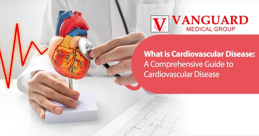 What is Cardiovascular Disease: A Comprehensive Guide to Cardiovascular Disease