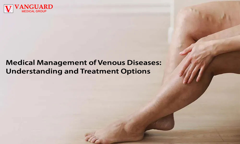 Medical Management of Venous Diseases: Understanding and Treatment Options