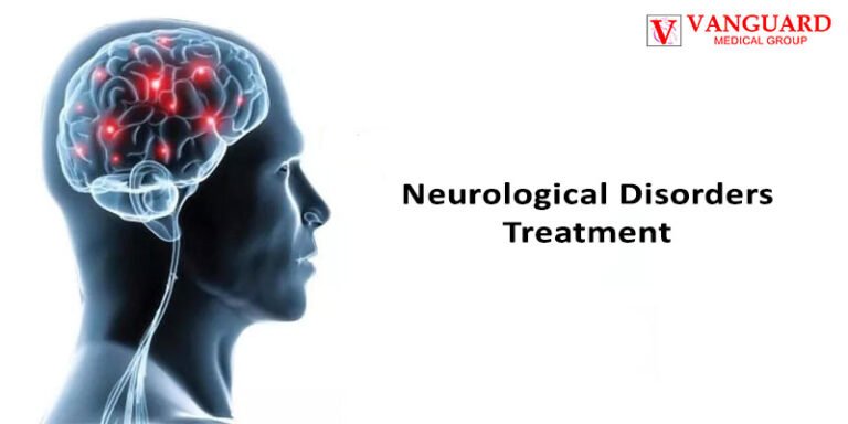 Neurological Disorders Treatment - Vanguard Medical Group